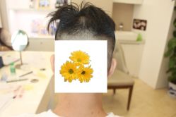 -大麦微针植发丨全国连锁