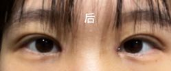 -杭州美莱医疗美容医院