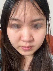 体验前-美瑞莎创美医疗美容