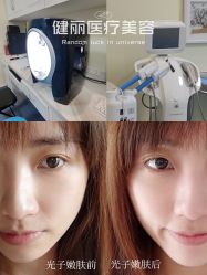 点击看大图 -广州健丽·去眼袋医疗美容机构