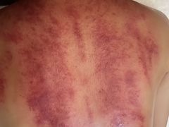 -SPA·印象足道养生(大运河度假区四望亭店)