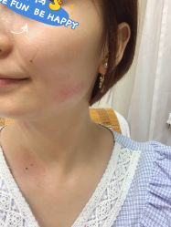 -北京美痣堂古方祛痣斑疣瘊