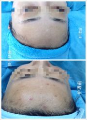 点击看大图 -肤原祛痘·科技修肤中心