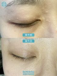 -清疣美疣·痣·斑净肤中心
