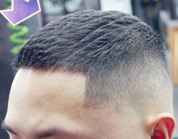 -大麦微针植发丨全国连锁