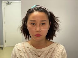 -小忠丽格医美