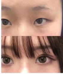 -素美医疗美容·西南眼鼻整形·修复基地