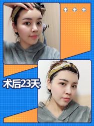 -广东韩妃整形外科医院