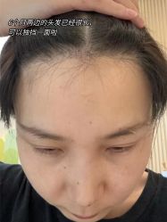 -雍禾植发全国连锁