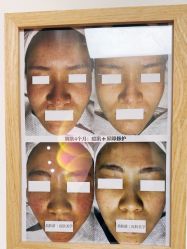 -美肤盾祛痘·问题肌头疗管理中心