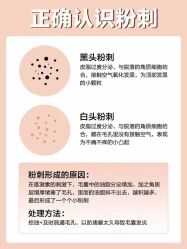 点击看大图 -美肤盾祛痘·问题肌头疗管理中心