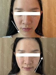 -AURAS璈然科技护肤中心