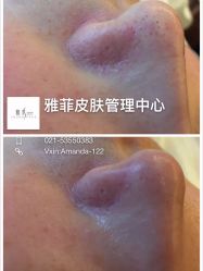 -苗方清颜·祛痘皮肤管理
