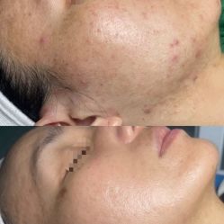 -SOS修丽可.痘肌修复中心