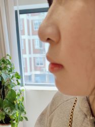 点击看大图 -Yestar宁波艺星整形医院