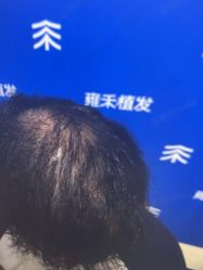 -雍禾植发全国连锁