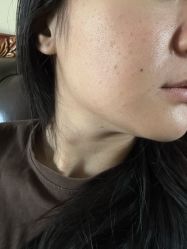 体验后-天津伊美尔医疗整形美容专科医院