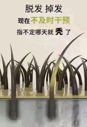 -顶尚堂白发脱发养发