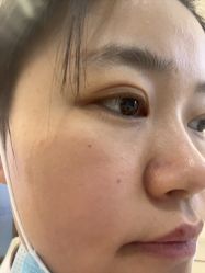 -长沙雅美医疗美容医院