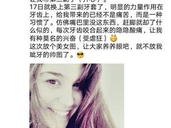 牙套叔日记-2014年6月19日-岳辰齿科(浦东长泰店)