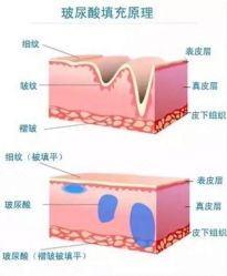 -上海时光整形外科医院