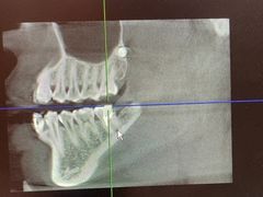 -土豆口腔(凤凰北总店)