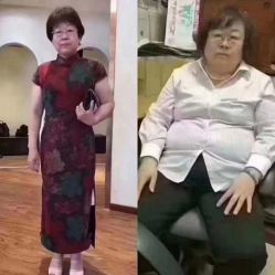 -苗塑堂减肥艾灸