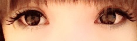 第七天画完妆-上海华安整形外科门诊部