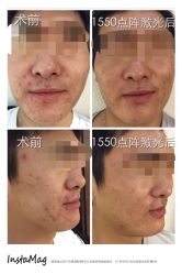 点阵-光SPA科技美肤