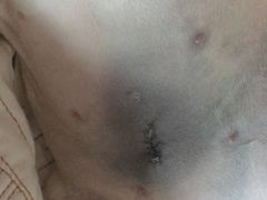 做完缝线，恢复的很好-芭比堂宠物医院·全科爱猫医院·仁德分院
