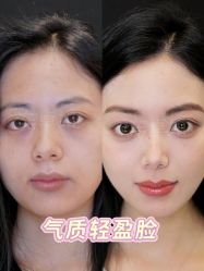 -Yestar重庆艺星医疗美容医院