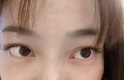 -宥莉·ULLY 痘敏肌•科技皮肤管理中心