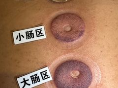 -莱仪堂艾灸经络养生馆(九亭一店)