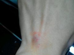 -东南大学附属中大医院(本部)