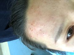 -大连市皮肤病医院