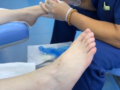 -Andrew指甲专科灰指甲·甲沟炎矫正·3D步态矫形鞋垫定制(浦三路店)