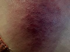 -天然沐足·推背采耳·敷姜艾灸(龙眼美食街店)