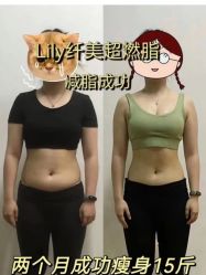 -Lily纤美·科技减脂中心