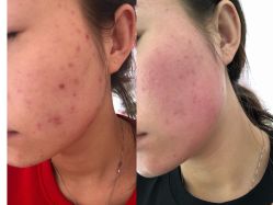 点击看大图 -IDEA·艾蒂尔科技美肤·日式美甲美睫集合店