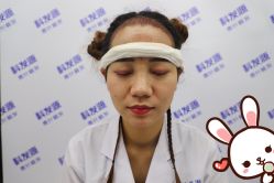 -大麦微针植发丨全国连锁