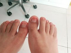 -新甲连锁灰指甲·甲沟炎·鸡眼(黑龙江路店)