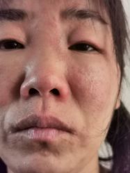 -安徽合肥韩美整形外科医院