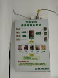 -德哥灰指甲脚气甲沟炎跖疣护理
