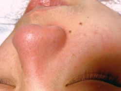 点击看大图 -莱尚·皮肤管理·痘肌护理