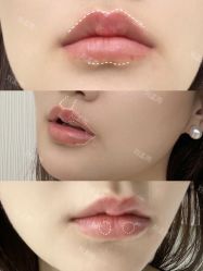 -木兰清颜医疗美容