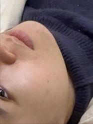 -长沙雅美医疗美容医院