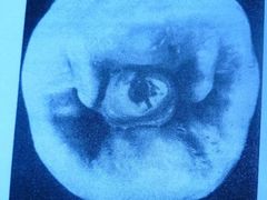 -上海曹洪喜口腔诊所