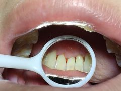 -土豆口腔(凤凰北总店)