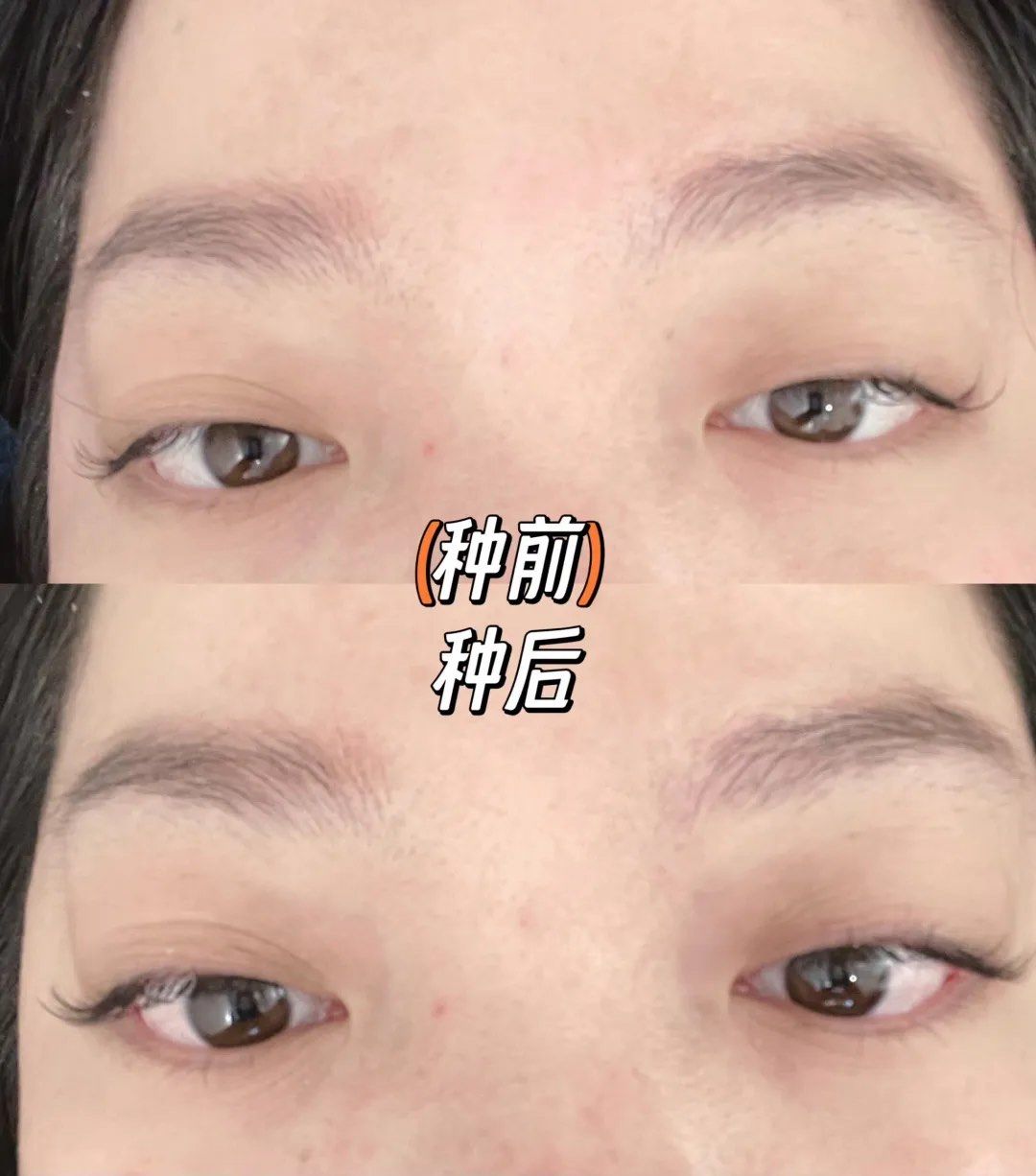 种睫毛被伤的最惨的一次
