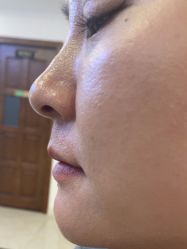 -长沙雅美医疗美容医院